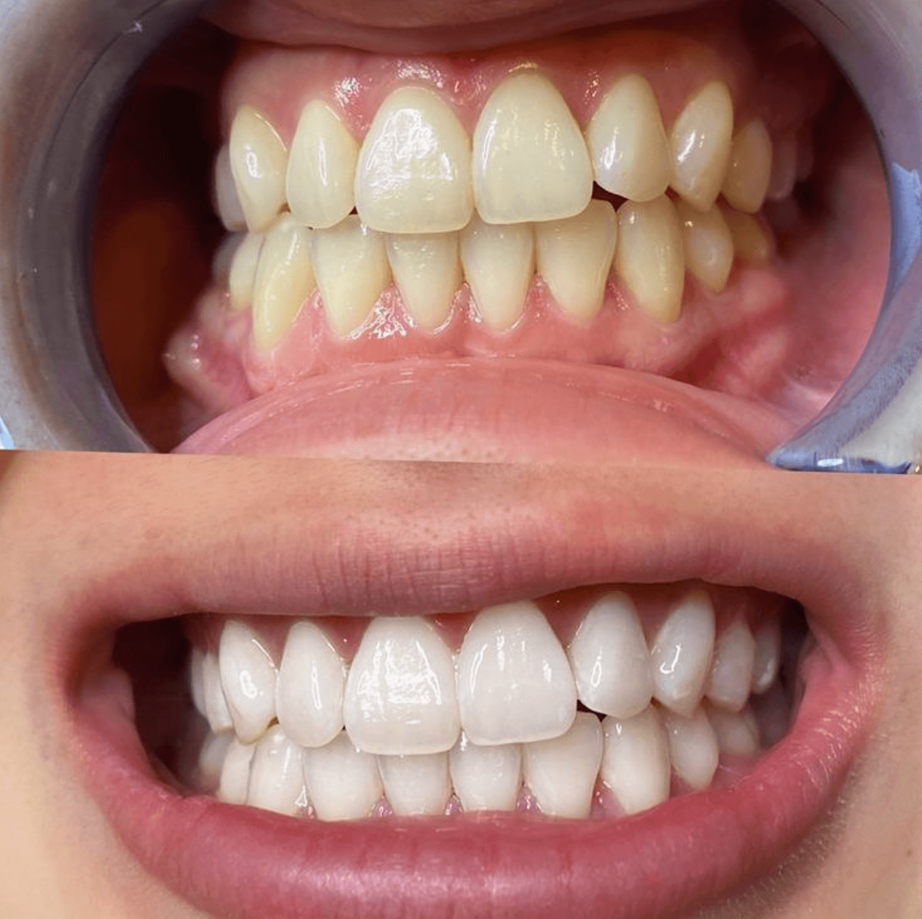 Antes e depois 7